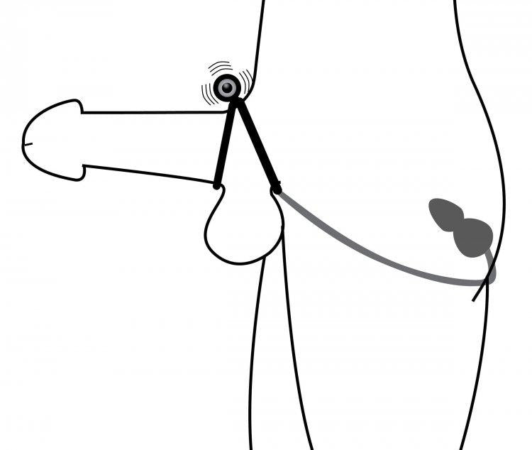 Master Series Prostatic Play Voyager 2 C Ring & Anal Stim